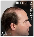 HairClub Coupon Code - 10% OFF